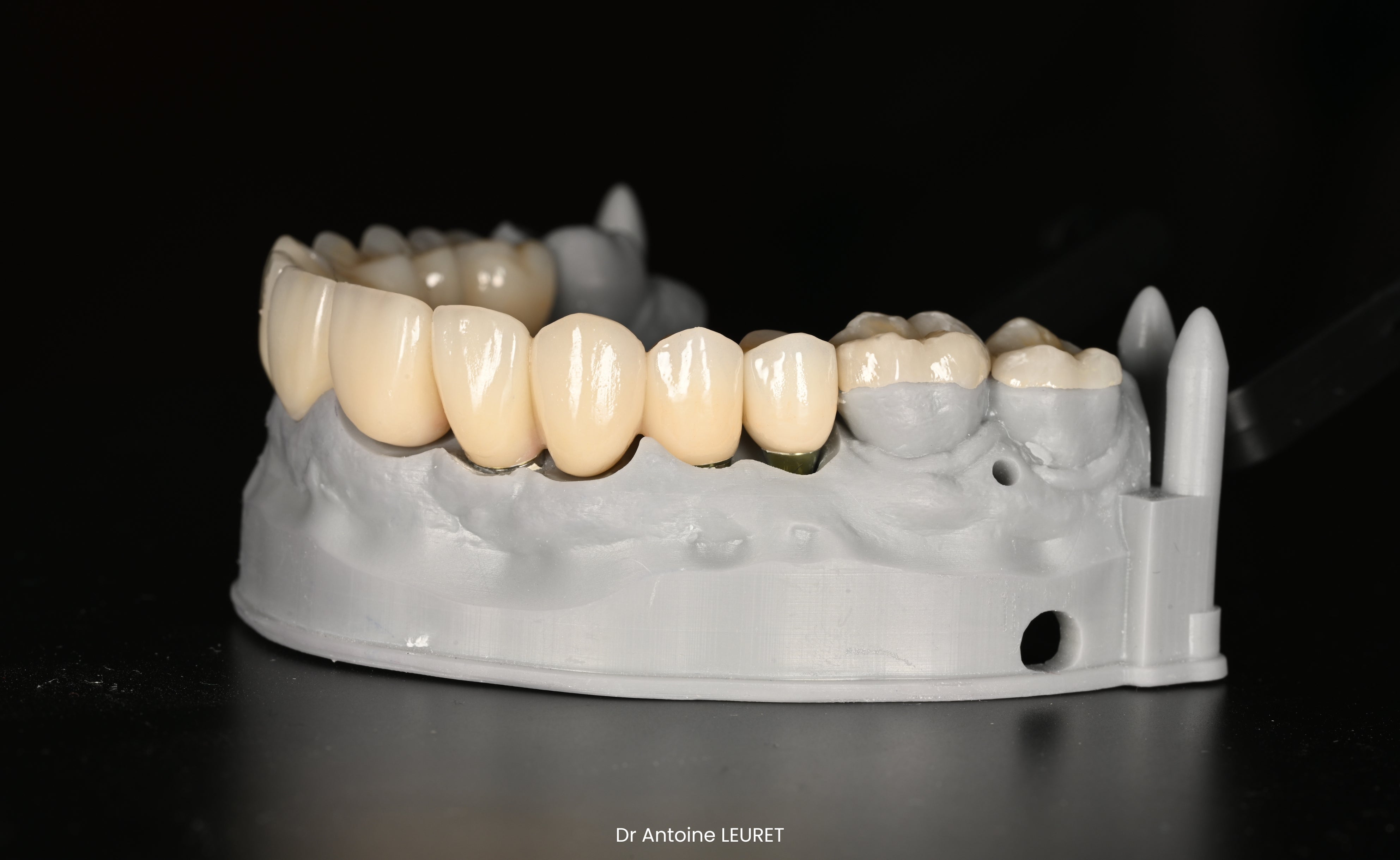 Restaurations directes & indirectes - Saison 1