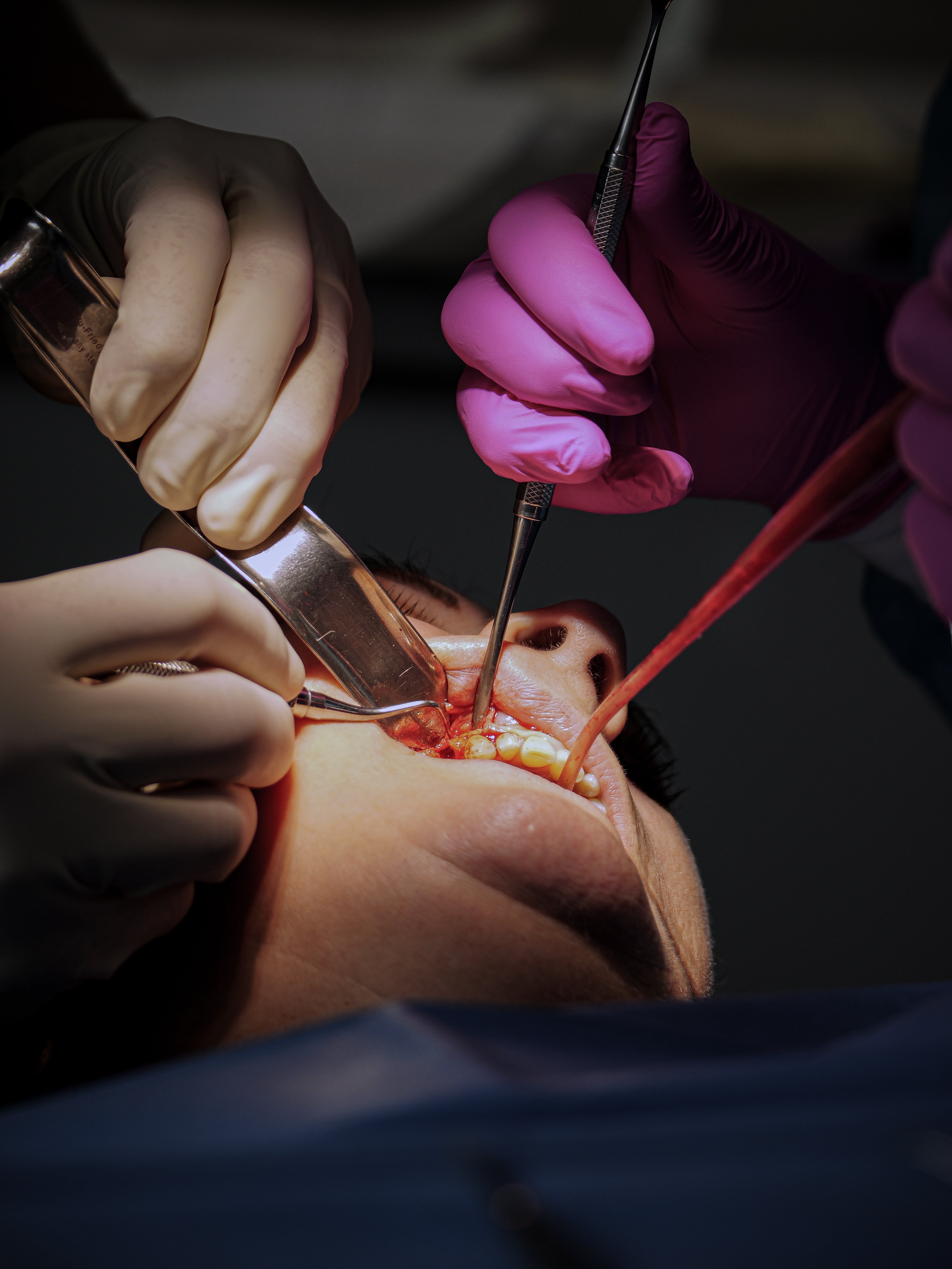 Endodontie - Saison 1