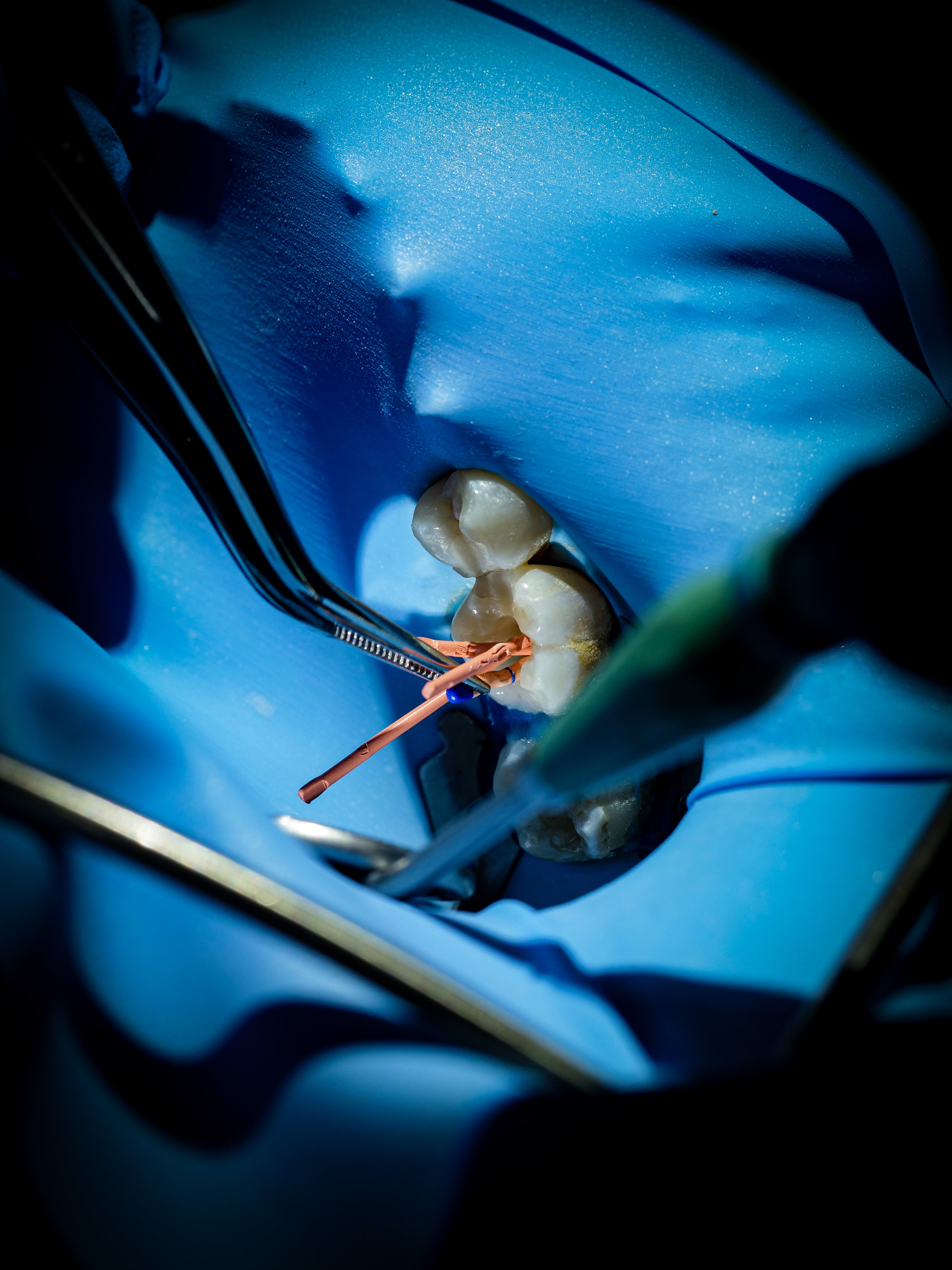 Endodontie - Saison 1