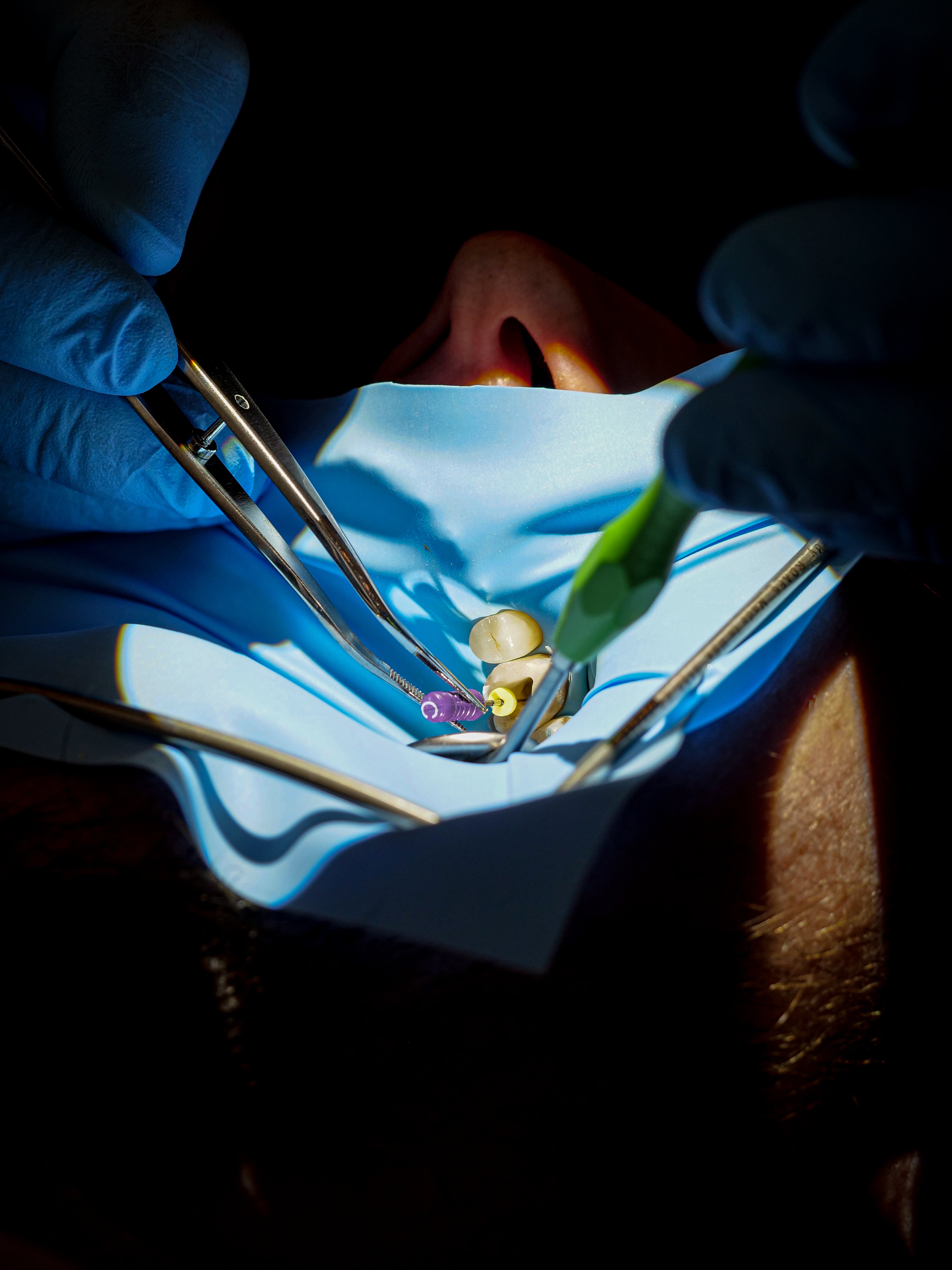 Endodontie - Saison 1