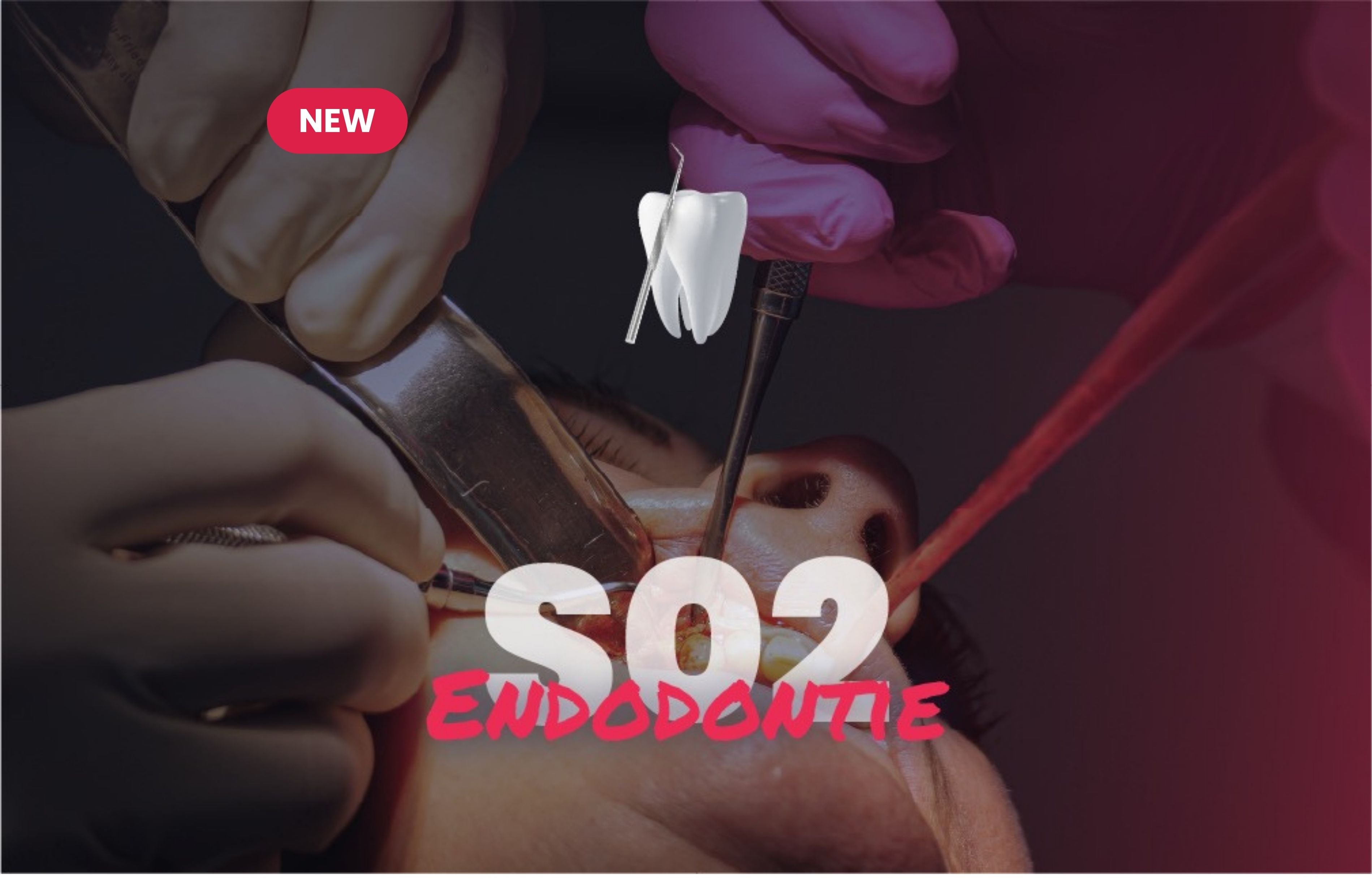 Endodontie - Saison 2