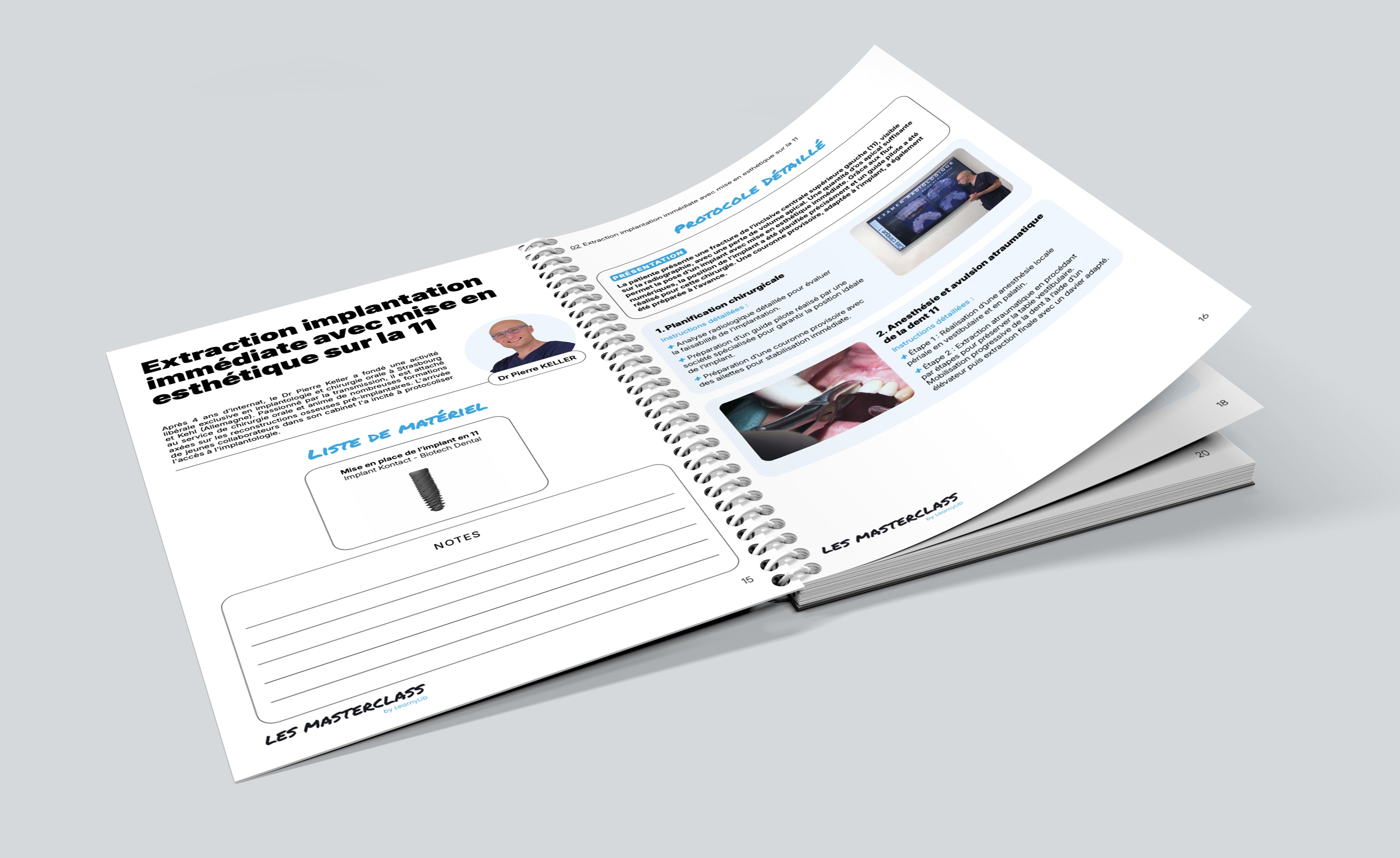 Livret de la MasterClass Implantologie & Chirurgie pré-implantaire - Saison 1