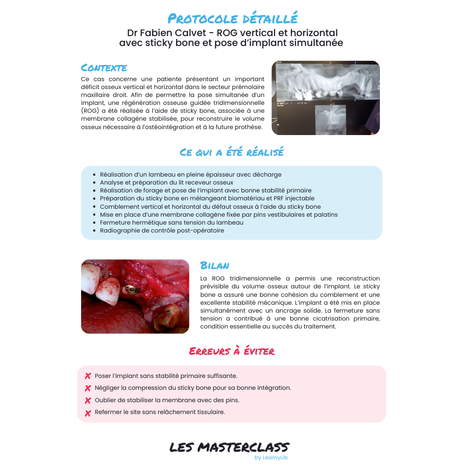 Implantologie et chirurgie pré-implantaire - Saison 1