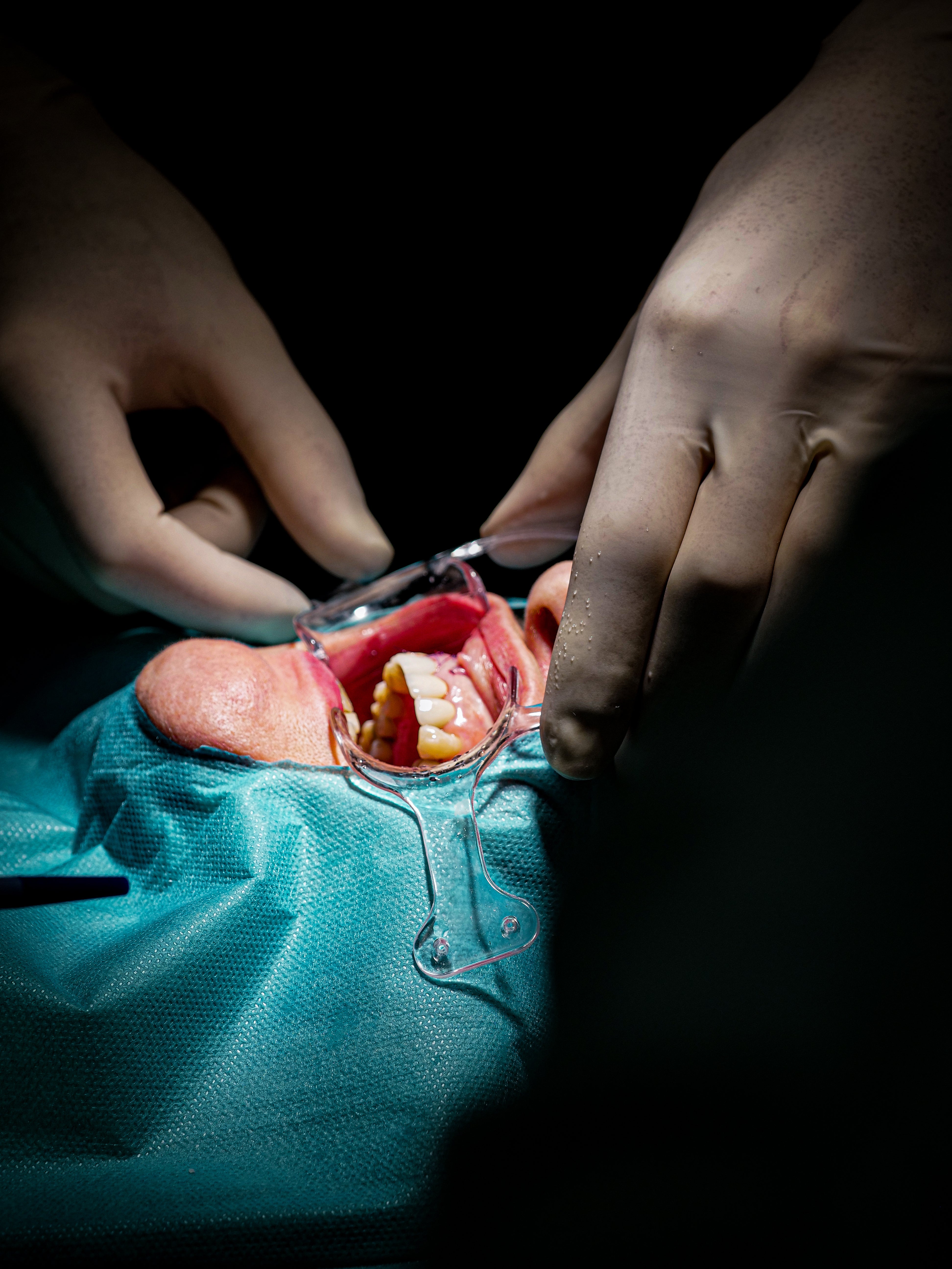 Implantologie et chirurgie pré-implantaire - Saison 1