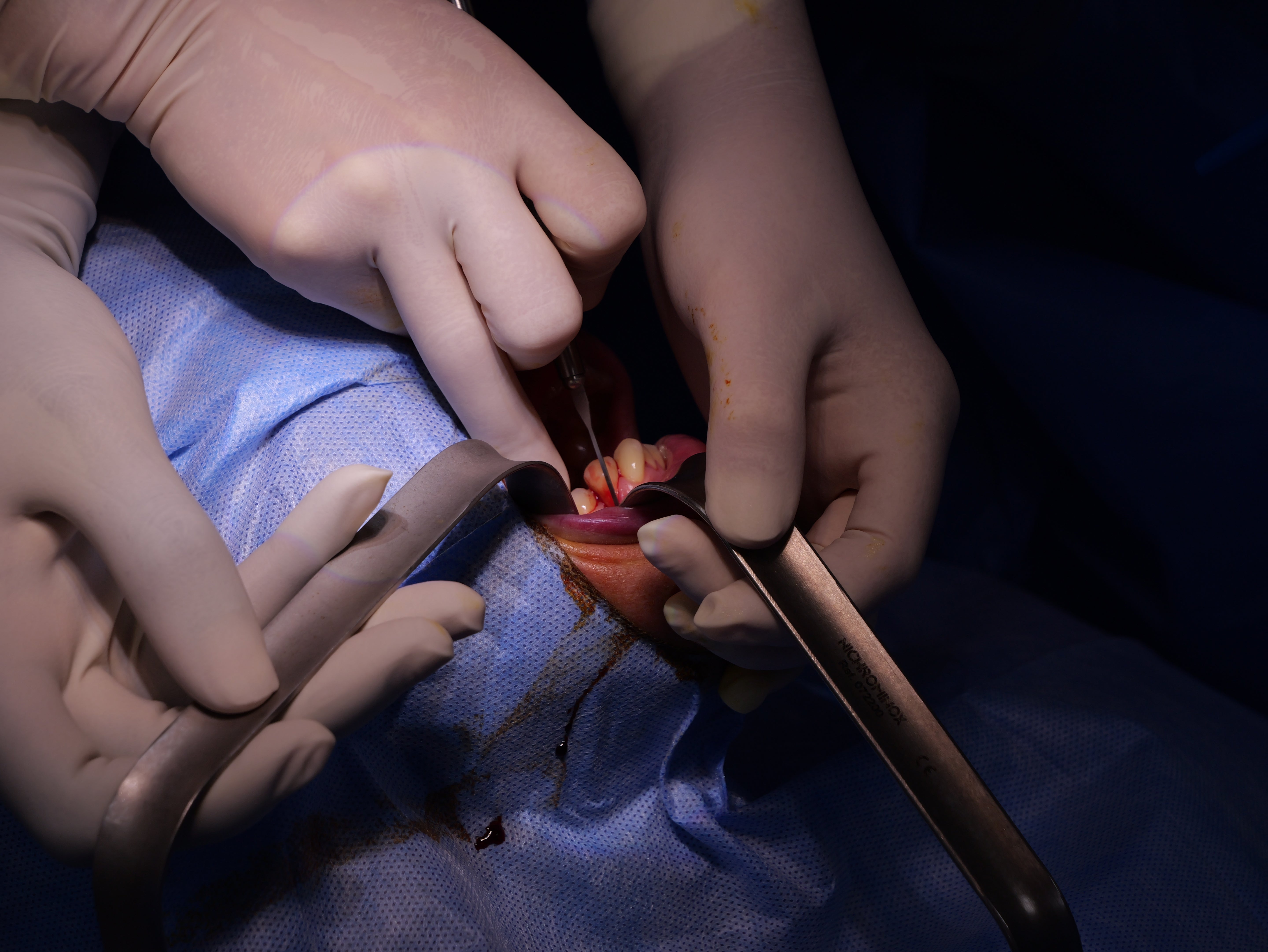 Parodontie & Chirurgie muco-gingivale - Saison 1