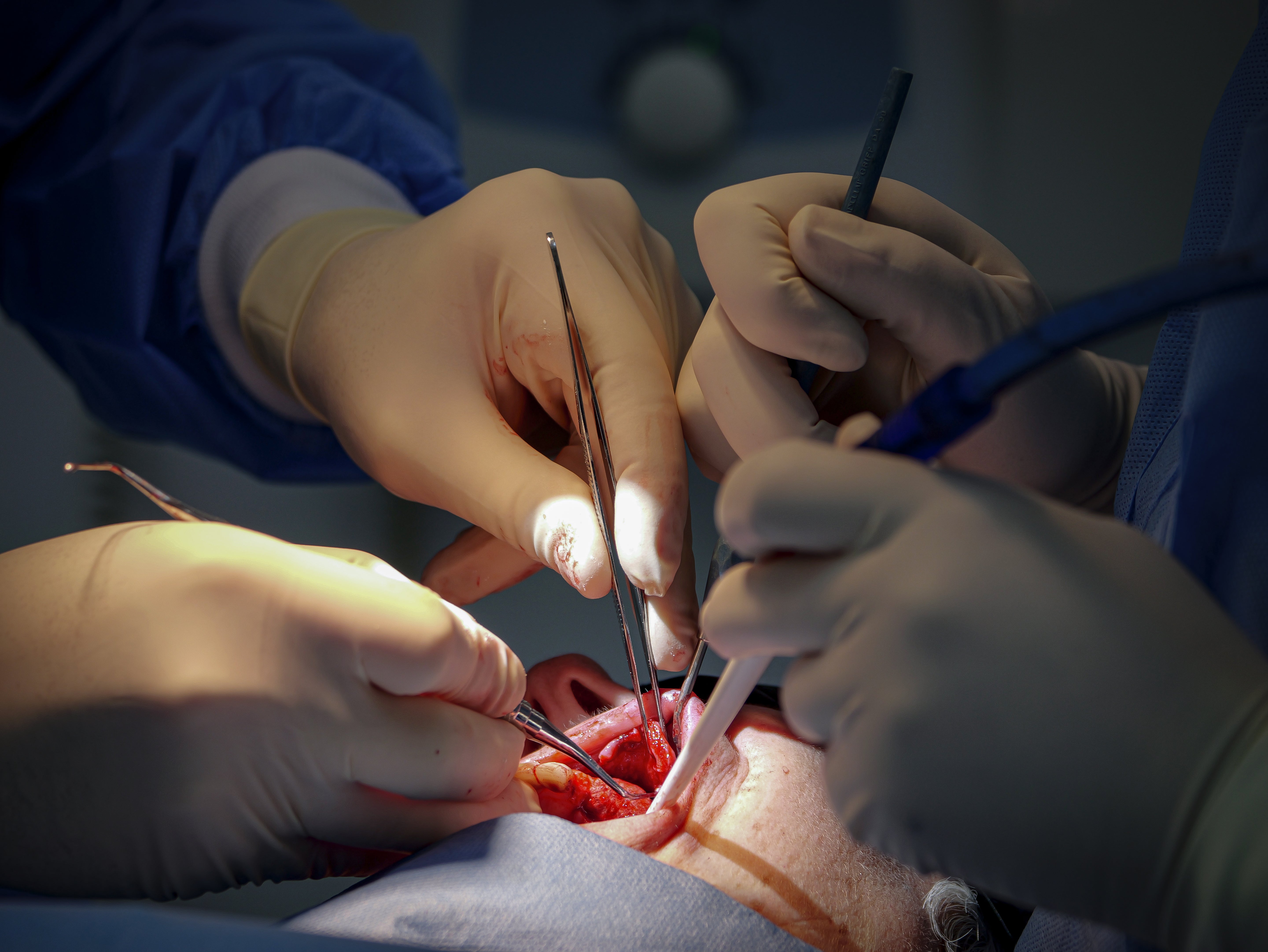 Implantologie et chirurgie pré-implantaire - Saison 2