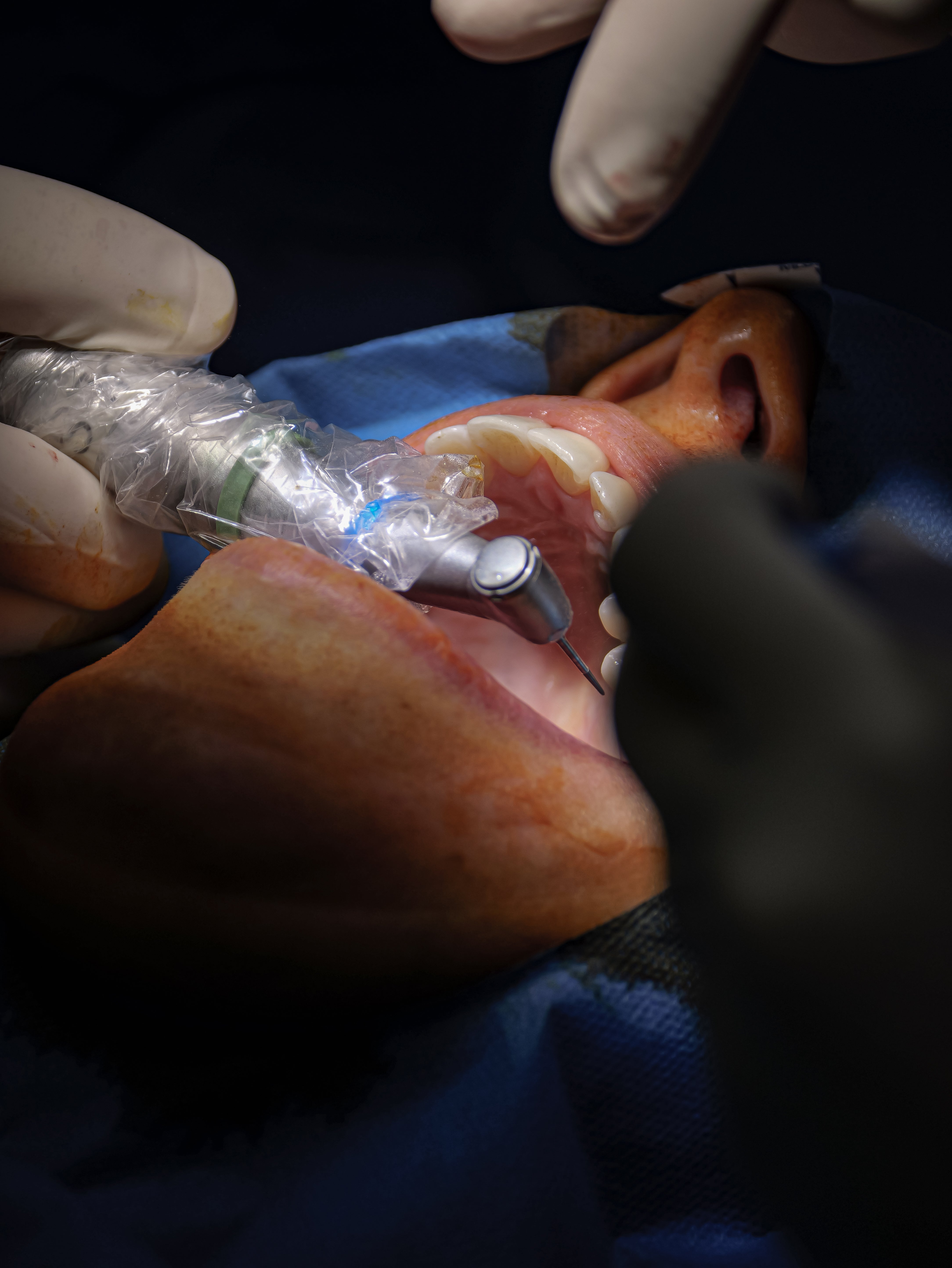 Endodontie - Saison 2