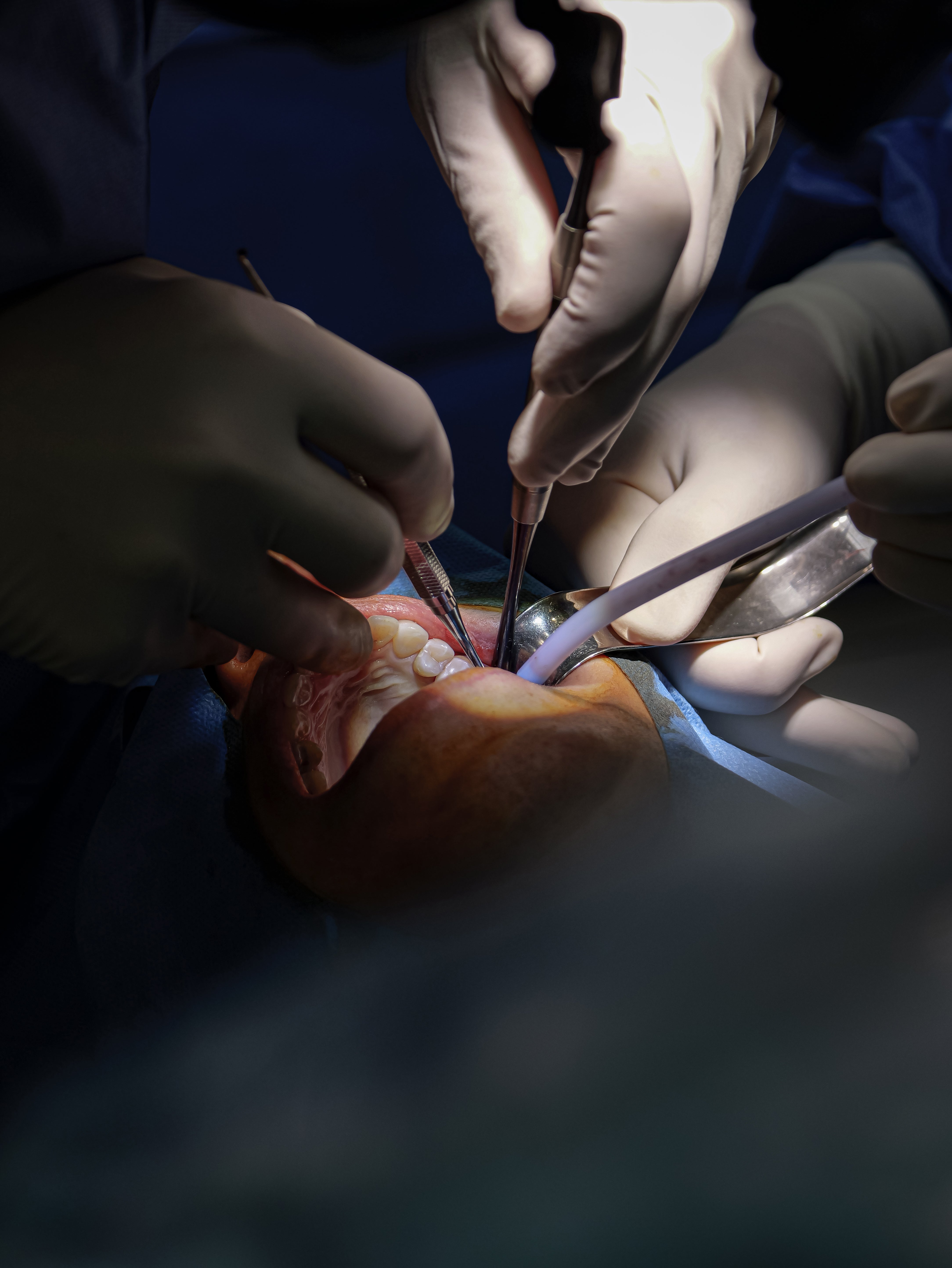 Endodontie - Saison 2