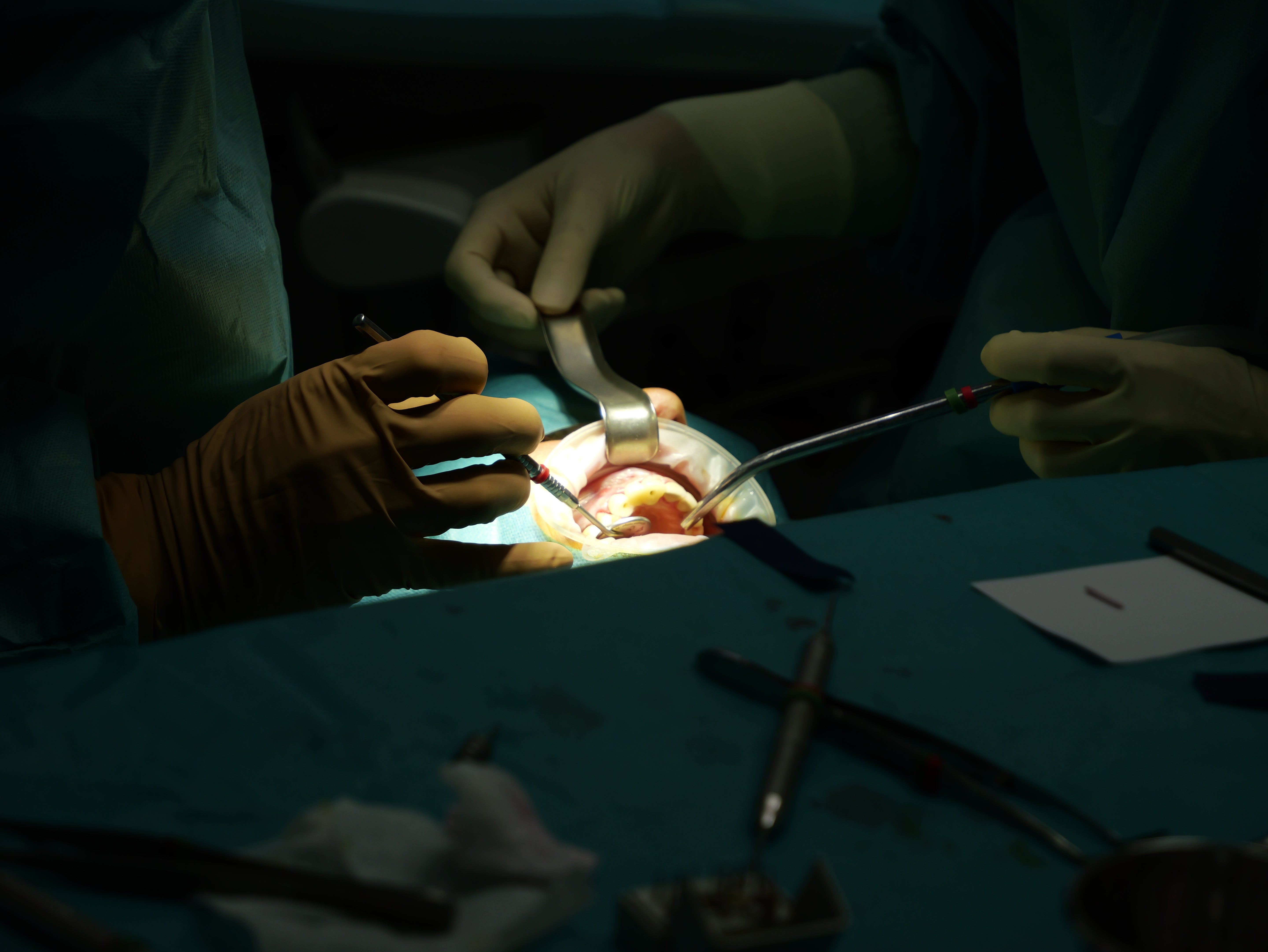 Implantologie et chirurgie pré-implantaire - Saison 2