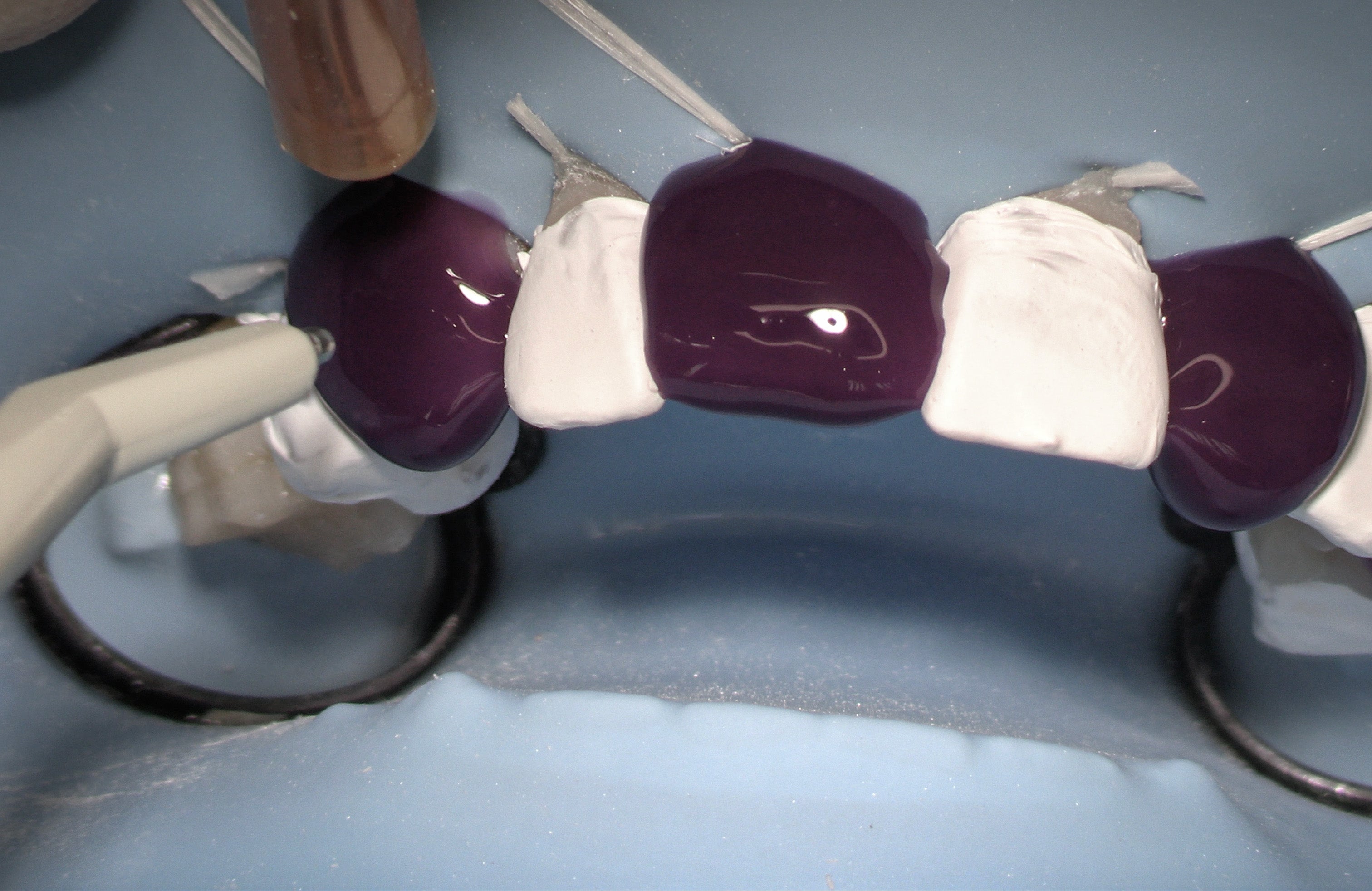 Restaurations directes & indirectes - Saison 1