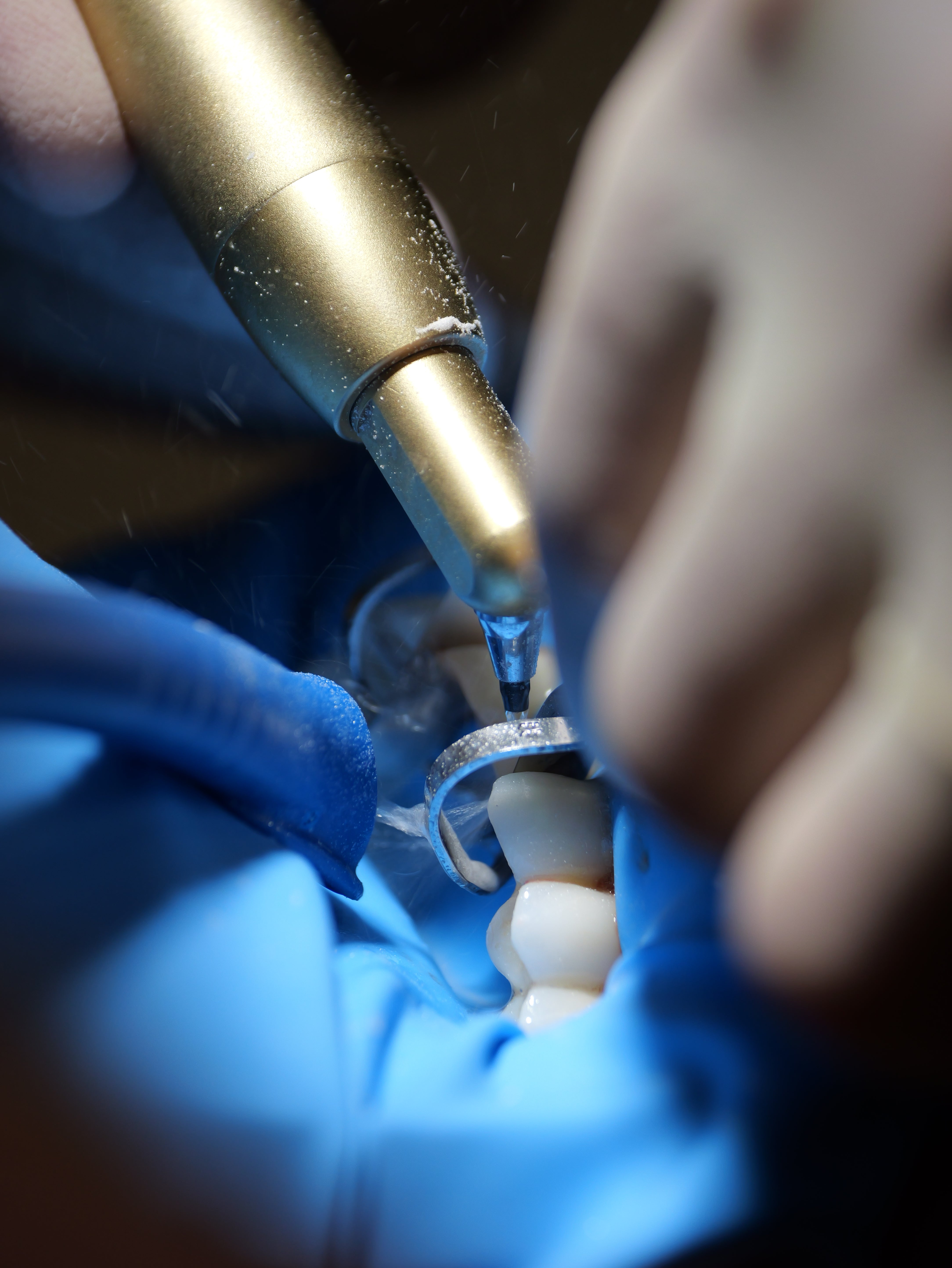 Restaurations directes & indirectes - Saison 1