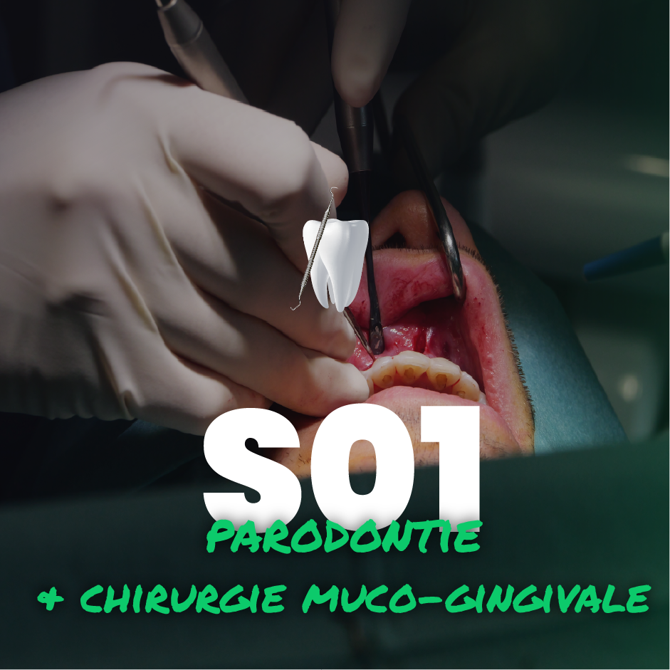 Parodontie & Chirurgie muco-gingivale - Saison 1