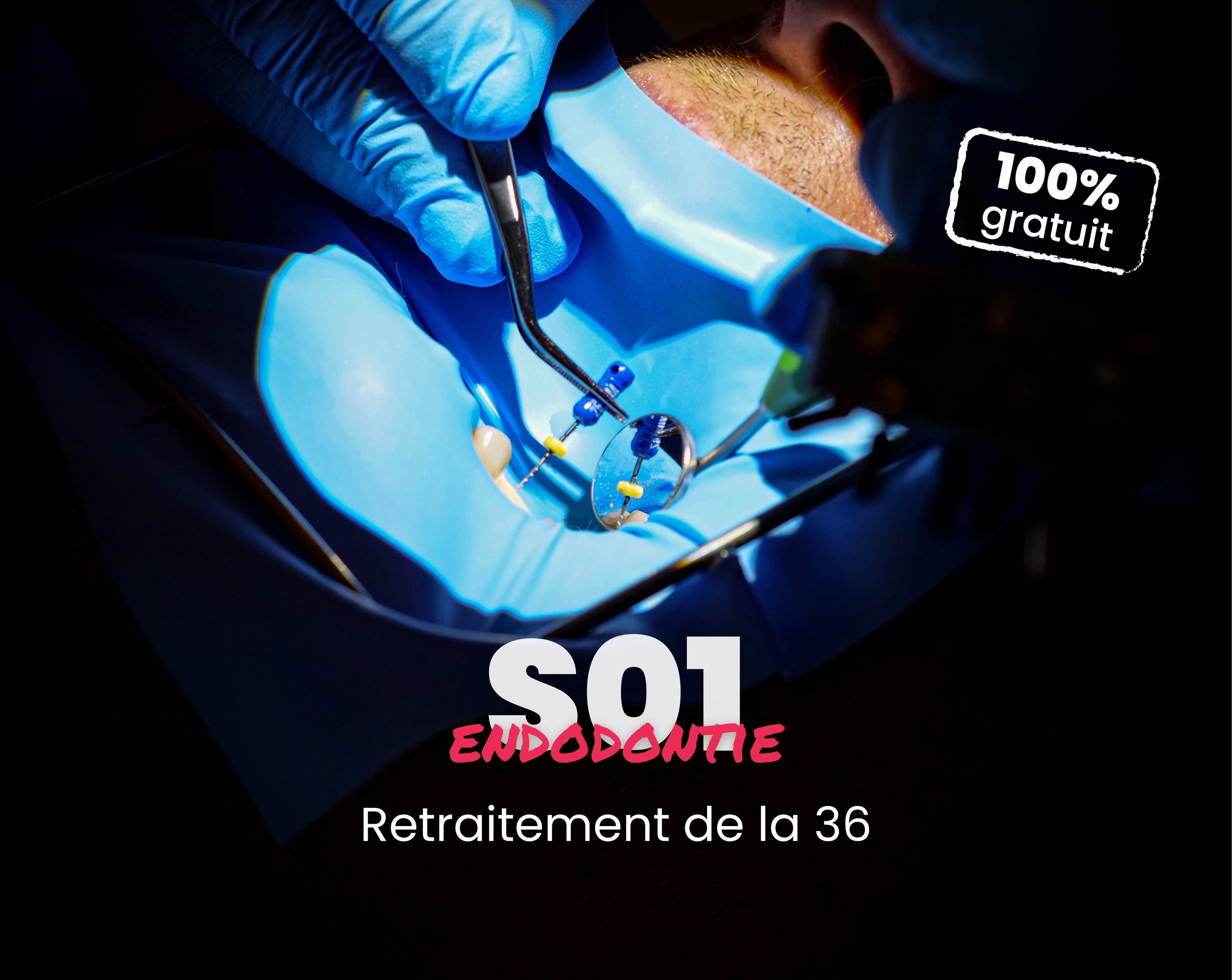 Extrait offert - MasterClass Endodontie Saison 1 - Retraitement de la 36