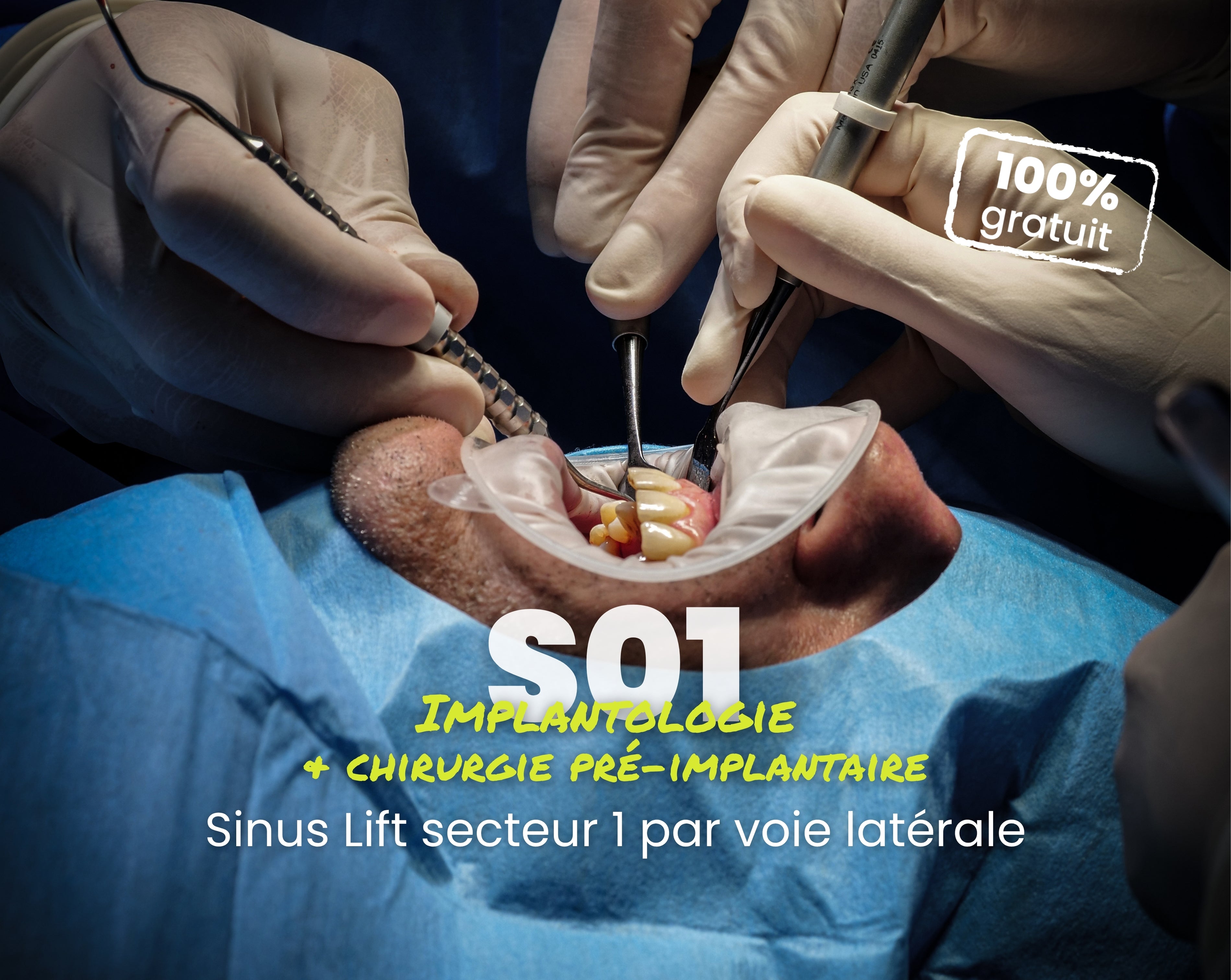 Extrait offert - MasterClass Implantologie Saison 1 - Sinus Lift secteur 1 par voie latérale