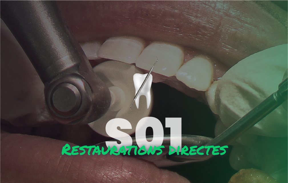 Restaurations directes - Saison 1