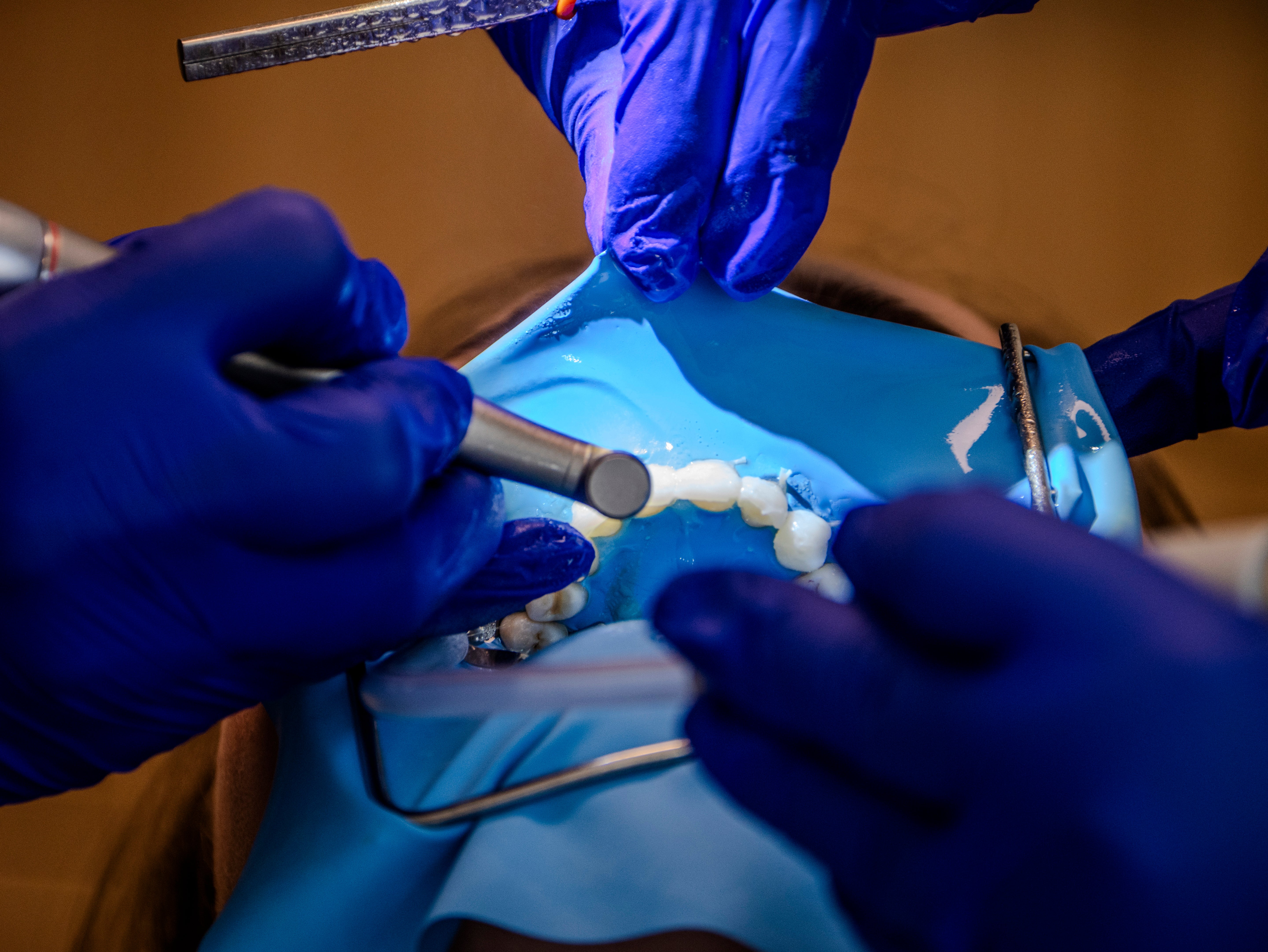 Restaurations directes & indirectes - Saison 1