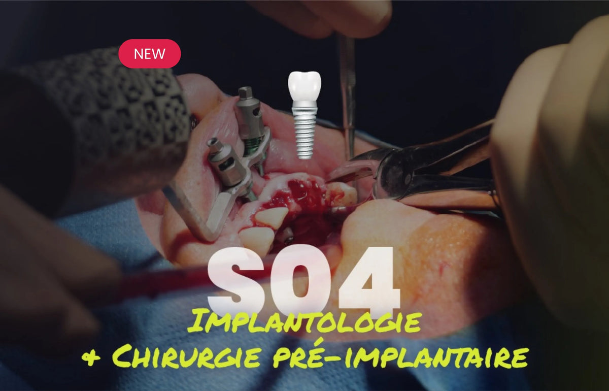 Implantologie et chirurgie pré-implantaire - Saison 4