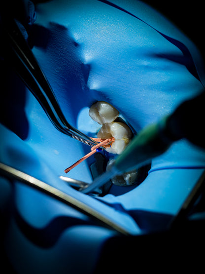 Endodontie - Saison 1