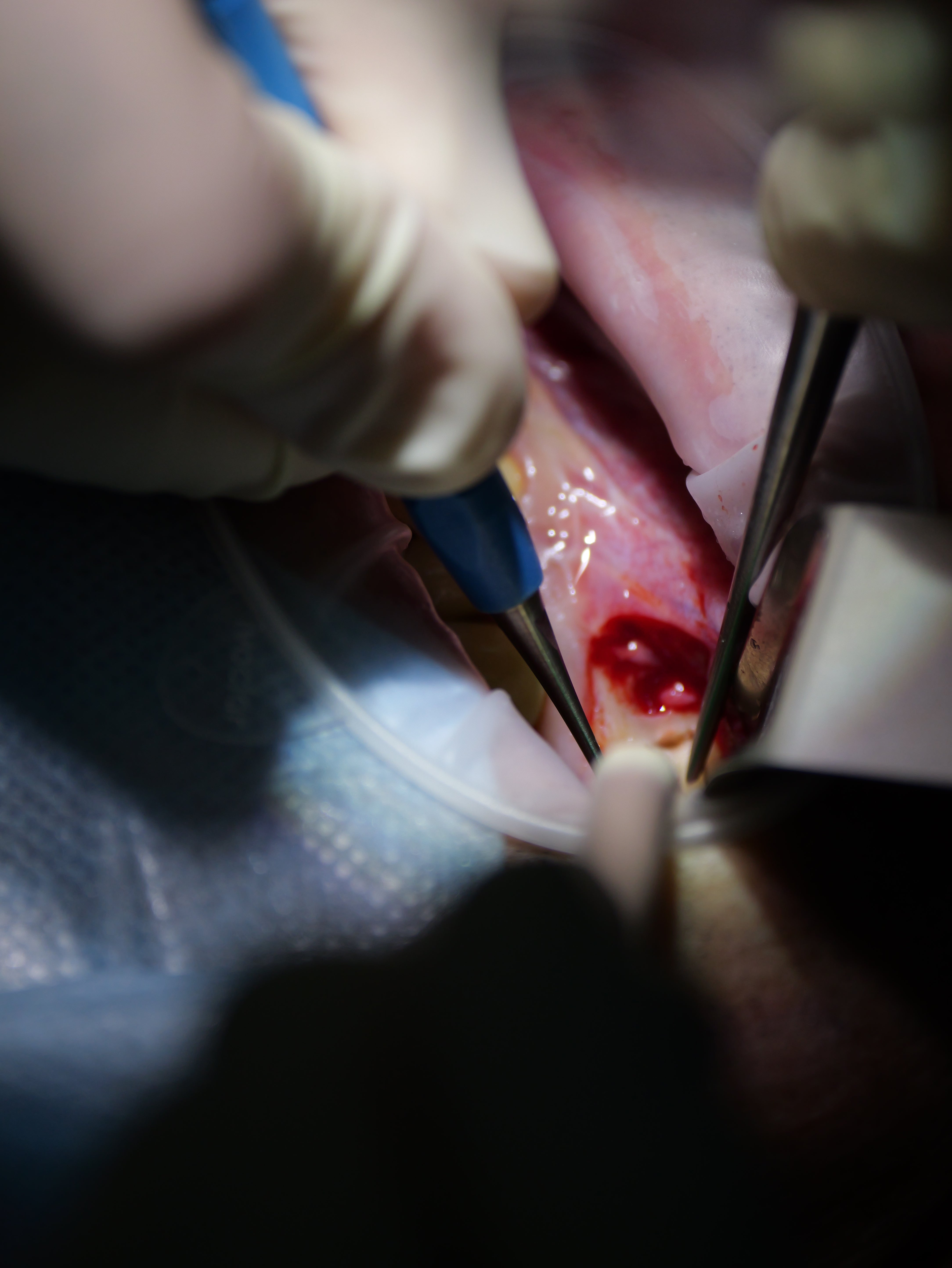 Endodontie - Saison 2