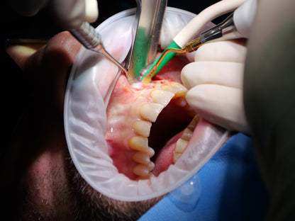 Endodontie - Saison 2