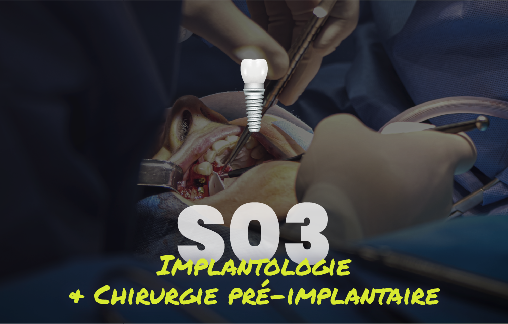 Implantologie et chirurgie pré-implantaire - Saison 3