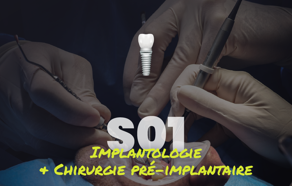 Implantologie et chirurgie pré-implantaire - Saison 1