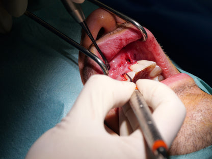 Parodontie & Chirurgie muco-gingivale - Saison 1