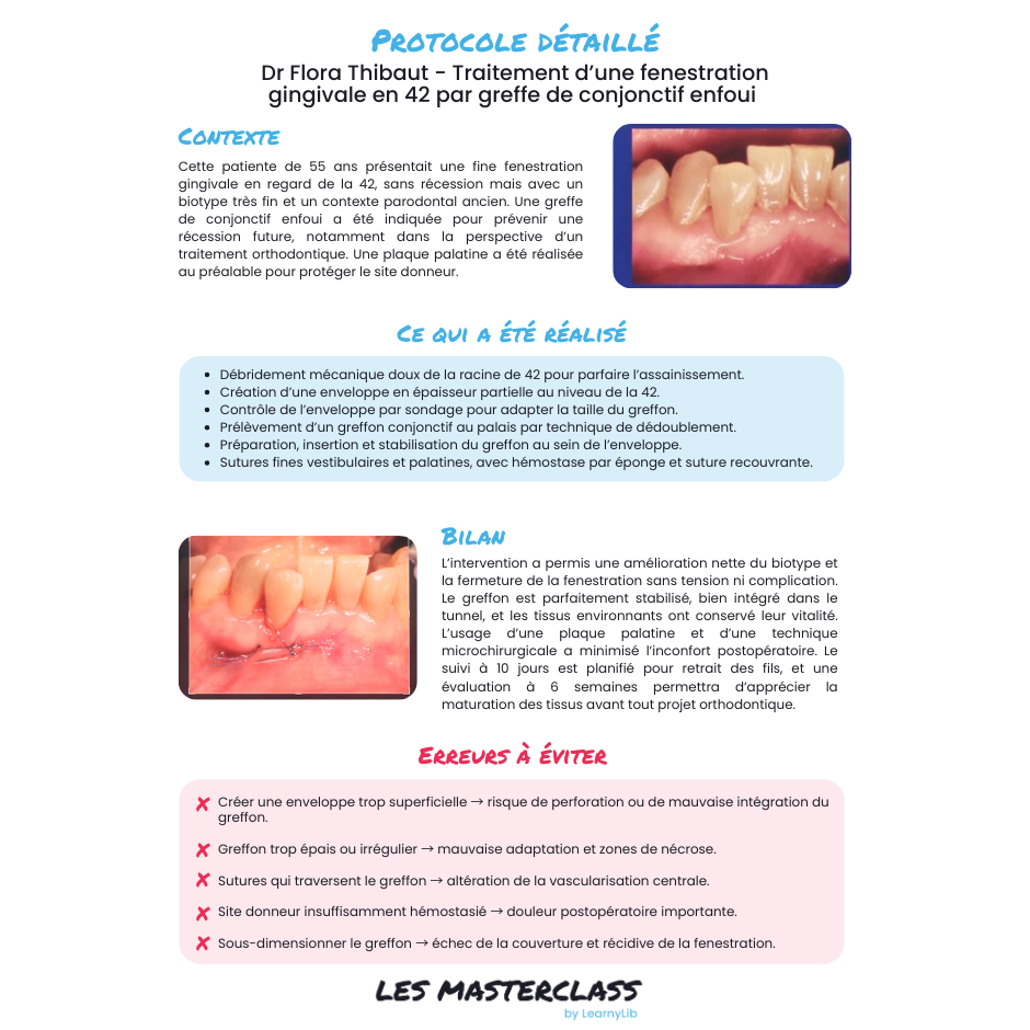 Parodontie & Chirurgie muco-gingivale - Saison 1