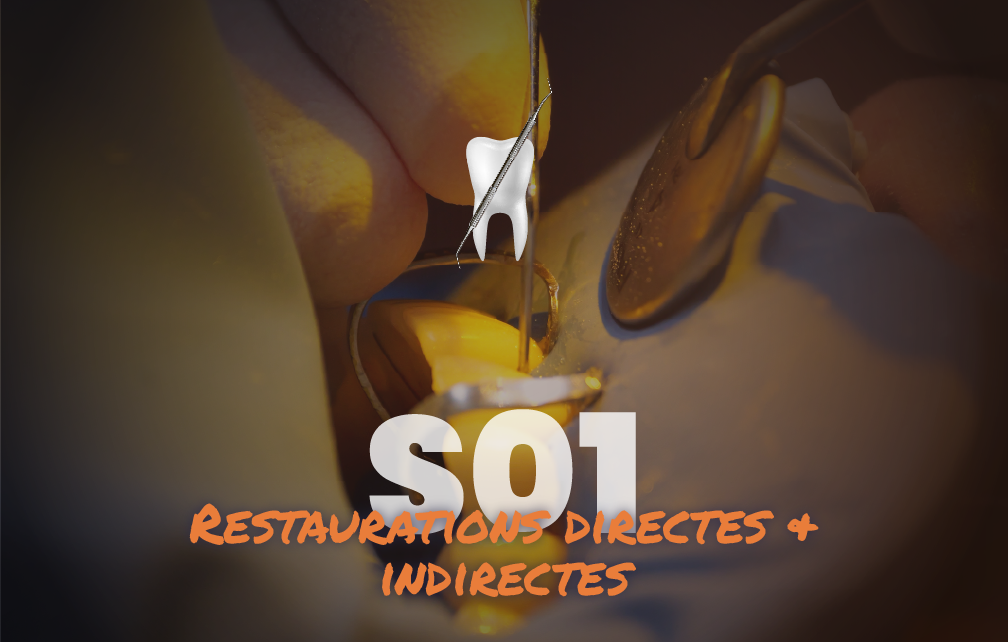 Restaurations directes & indirectes - Saison 1