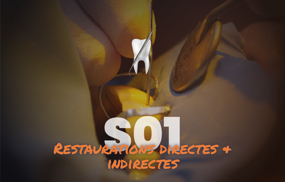 Restaurations directes & indirectes - Saison 1