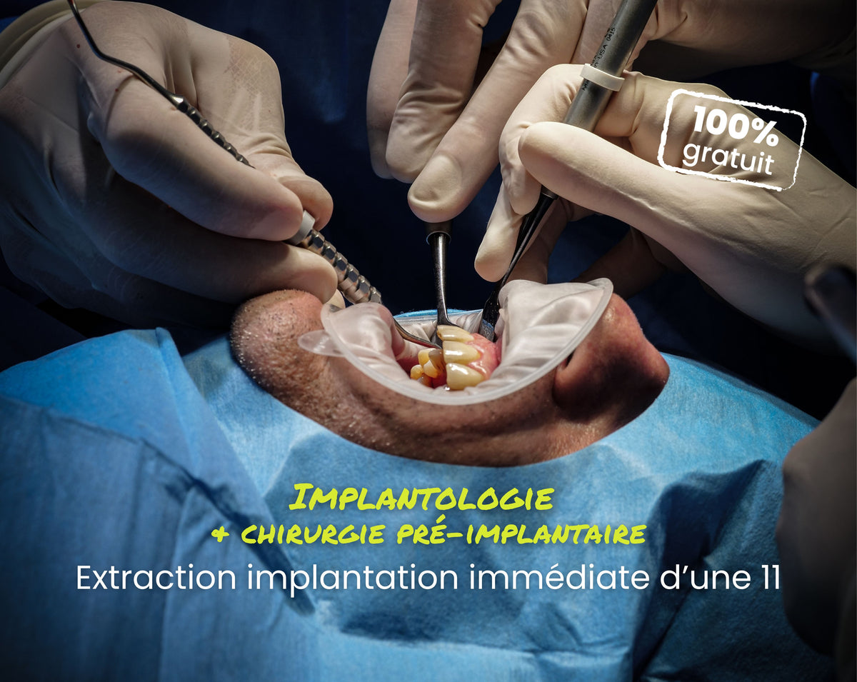 Extrait offert - MasterClass Implantologie - Extraction implantation immédiate d’une 11