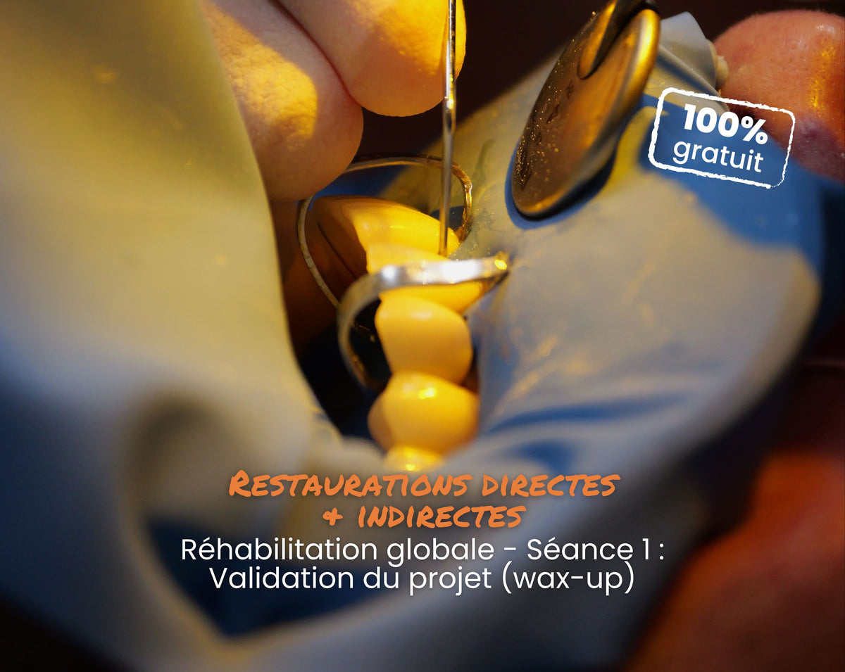 Extrait offert - MasterClass Restaurations directes & indirectes - Réhabilitation globale - Séance 1 : Validation du projet (wax-up)