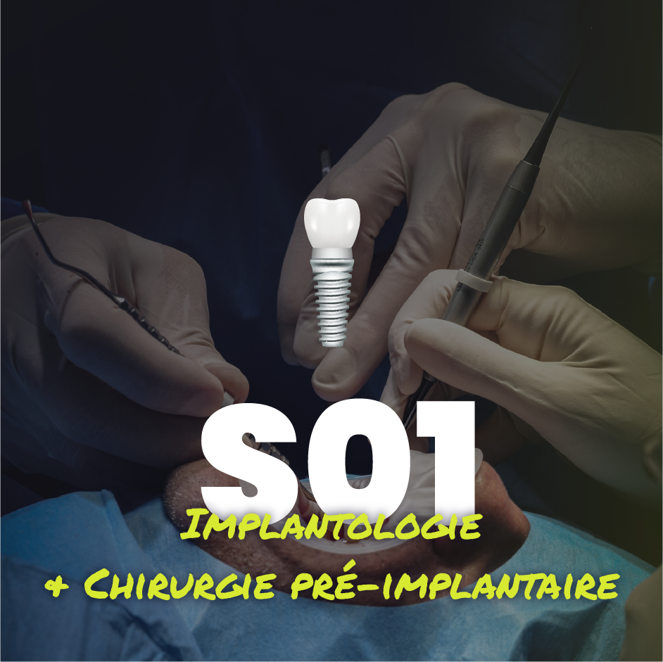 Implantologie et chirurgie pré-implantaire - Saison 1