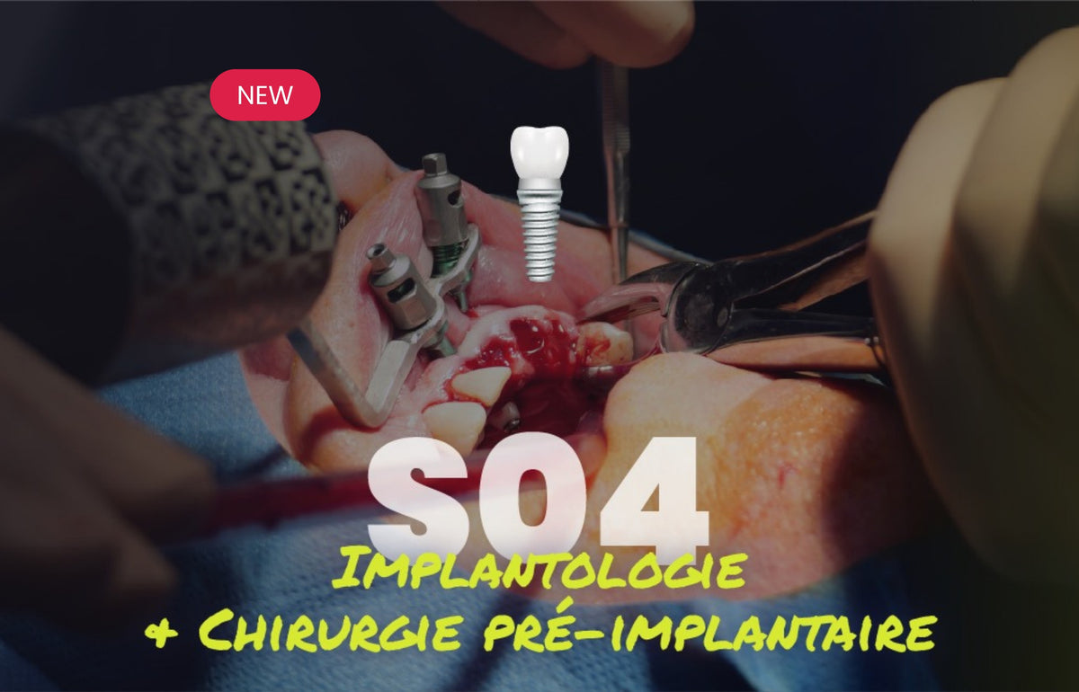 Charger la vidéo: Implantologie et chirurgie pré-implantaire - Saison 4