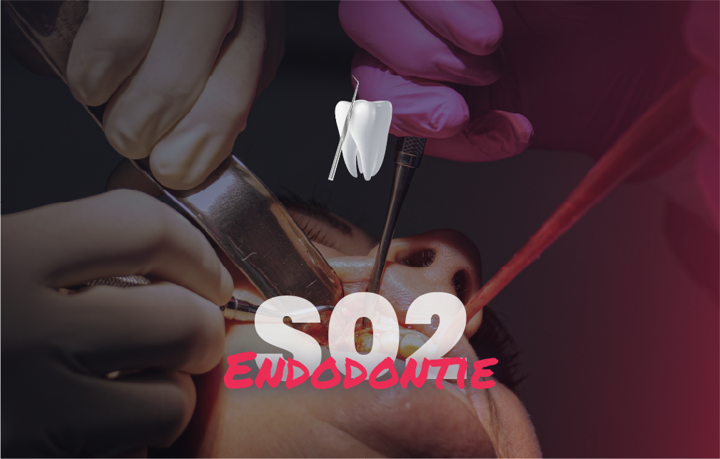 Charger la vidéo: Endodontie - Saison 2