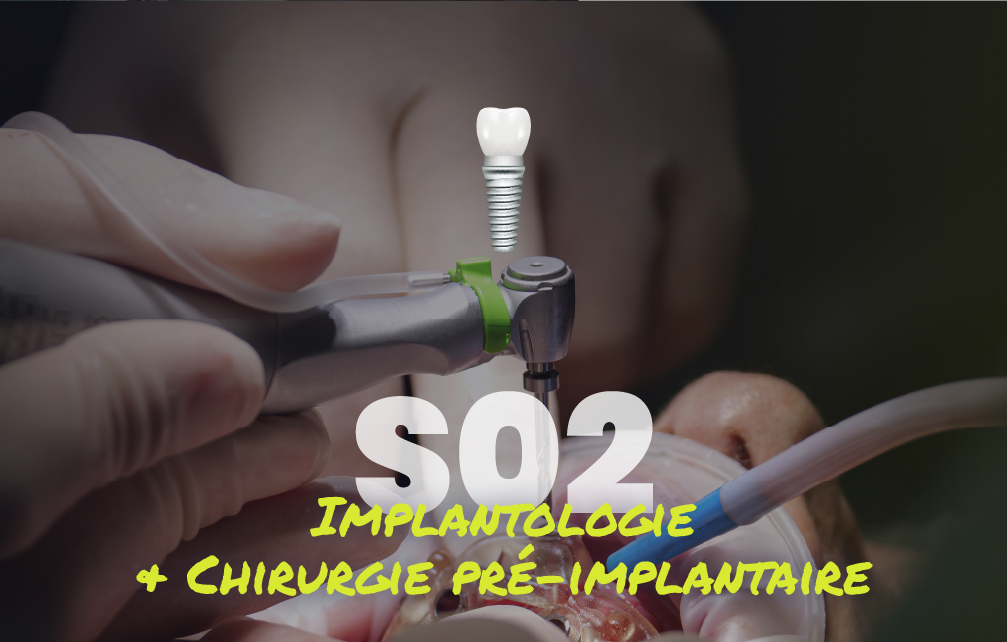 Charger la vidéo: Implantologie et chirurgie pré-implantaire - Saison 2