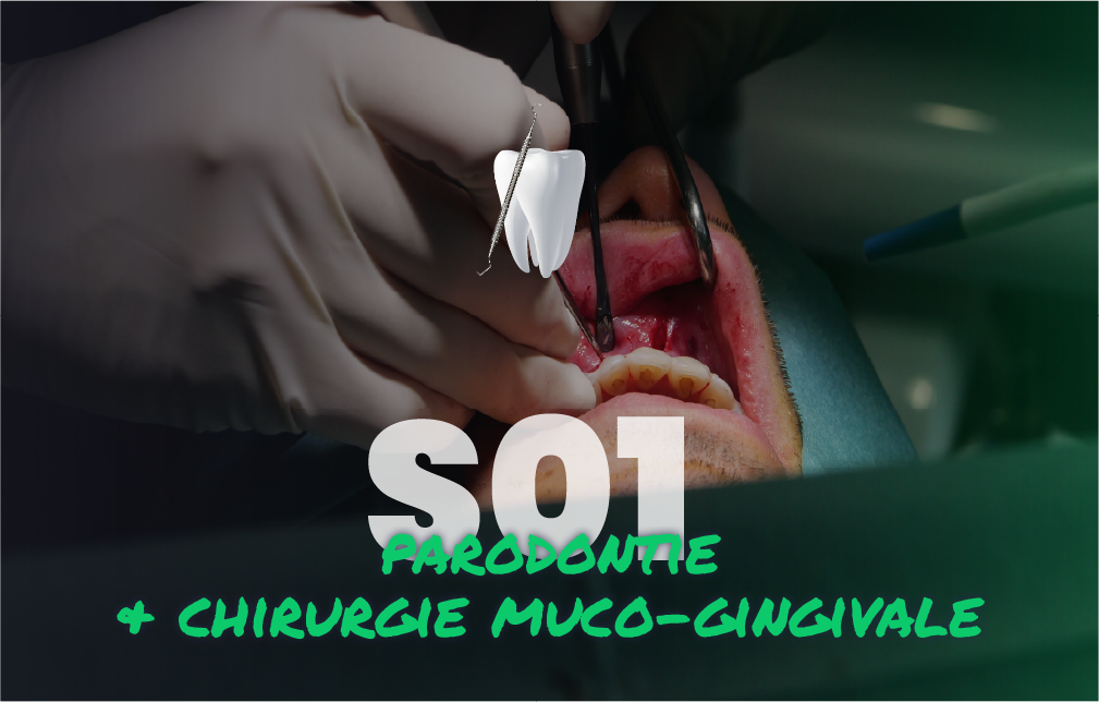 Charger la vidéo: Parodontie &amp; Chirurgie muco-gingivale - Saison 1